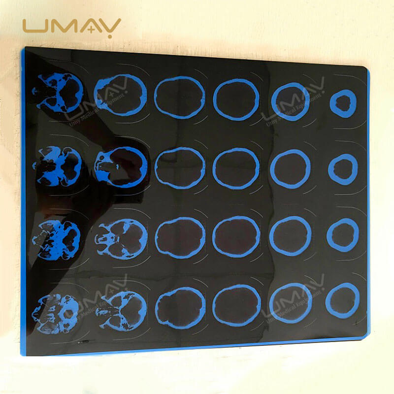 Durable X-ray Printer for Reliable Medical Imaging Applications