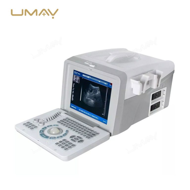 Portable Ultrasound Scanner UMY-US-PO01 Hot Sell in Africa