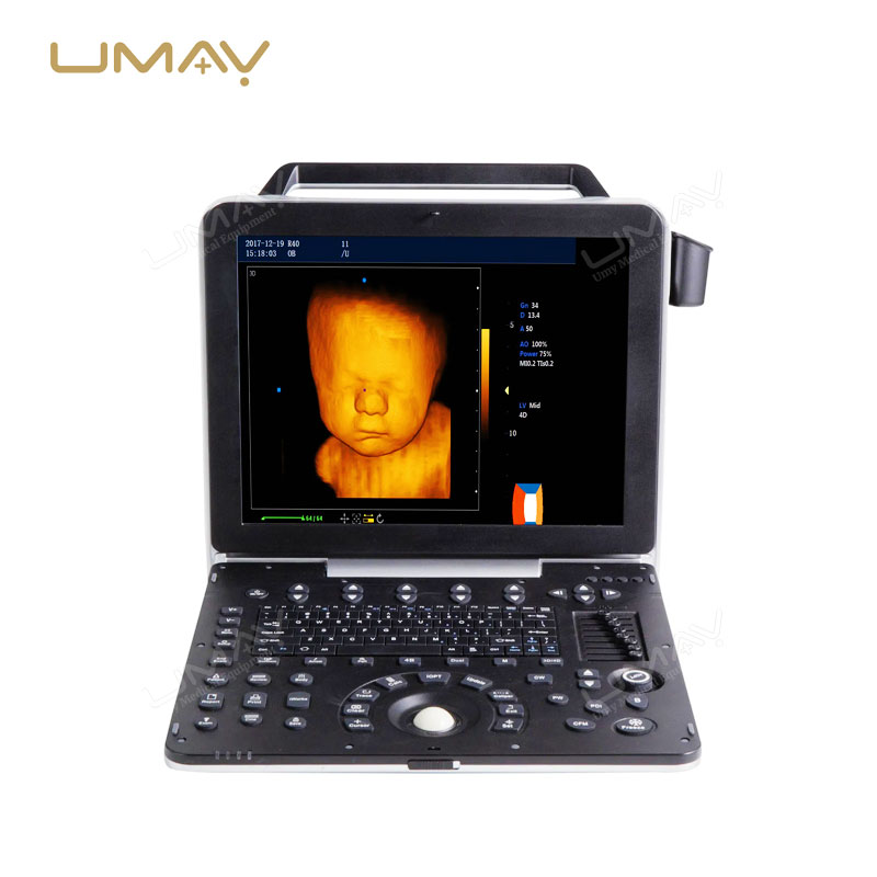 15-Inch High-Resolution Portable 4D/5D Color Doppler Ultrasound Machine