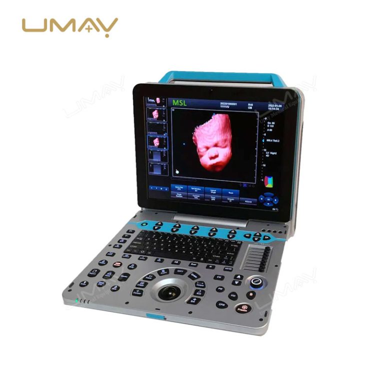 15-Inch High-Resolution Portable 4D 5D Color Doppler Ultrasound Machine-3