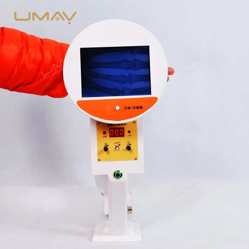 2024 Handheld Portable Digital X-ray Machine for Mobile Medical Imaging