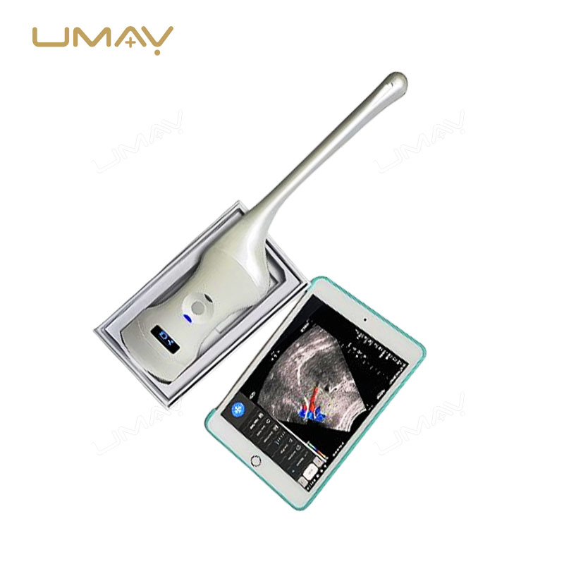 3-in-1 Wireless Color Doppler Ultrasound Scanner with Convex, Phased, and Transvaginal Array Probes