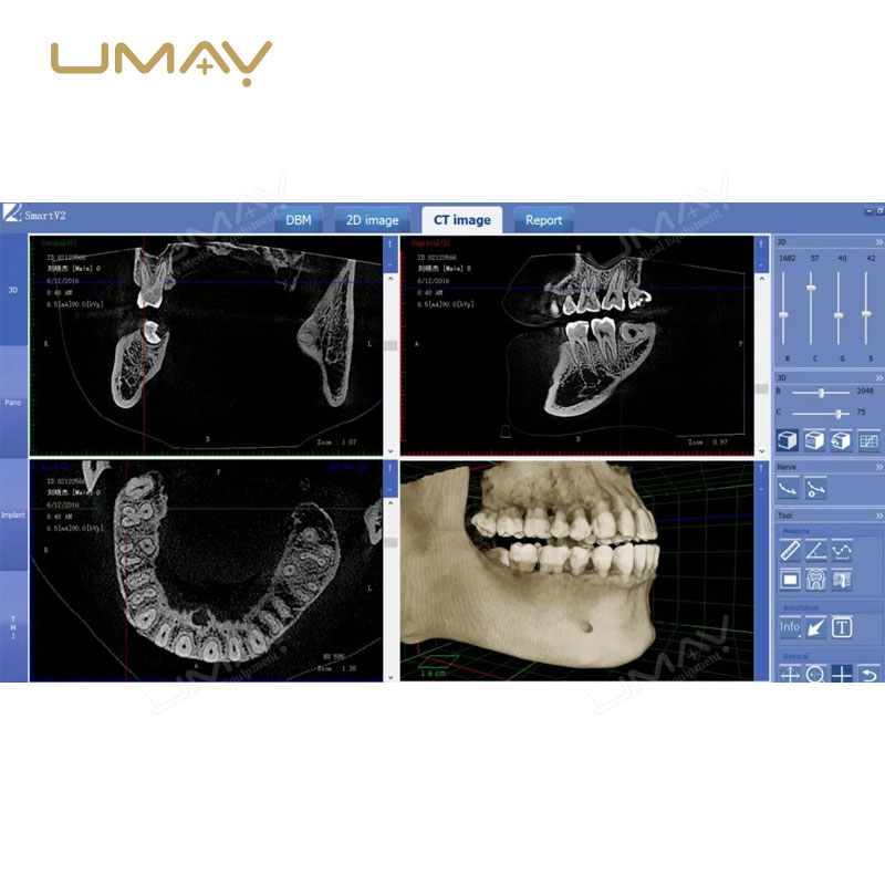 3D CBCT Panoramic and Cephalometric Dental X-ray Machine for Comprehensive Imaging