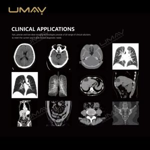 Affordable 32-slice CT Scanner with Professional Advanced Technology-2