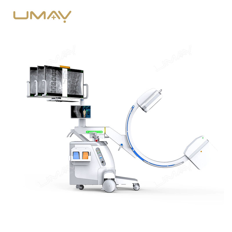 All-in-One Mobile C-Arm System with FPD for Orthopedics, Urology, and Gynecology