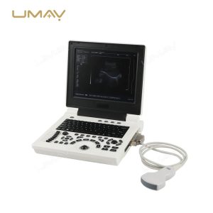 Digital Black and White Laptop Ultrasound Machine at Factory Price-1