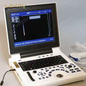 Digital Black and White Laptop Ultrasound Machine at Factory Price-2