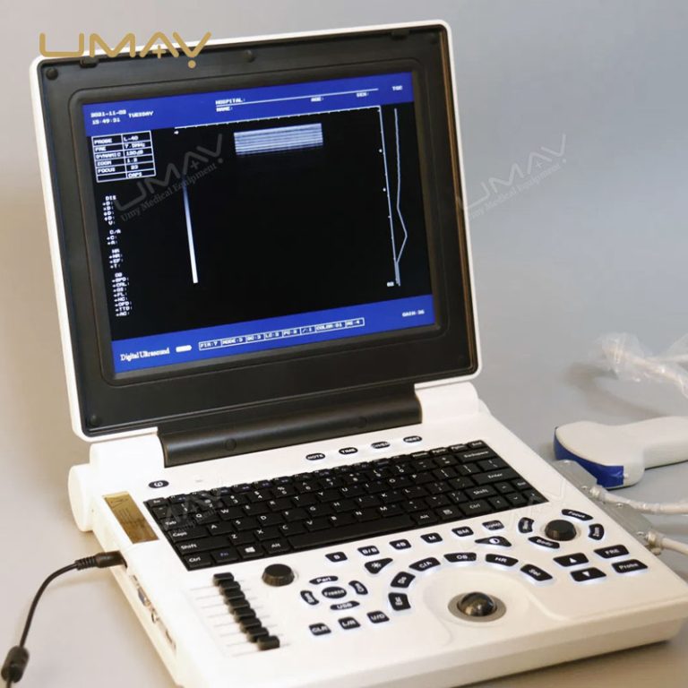 Digital Black and White Laptop Ultrasound Machine at Factory Price-2