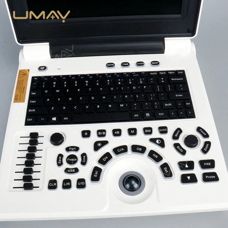 Digital Black and White Laptop Ultrasound Machine at Factory Price