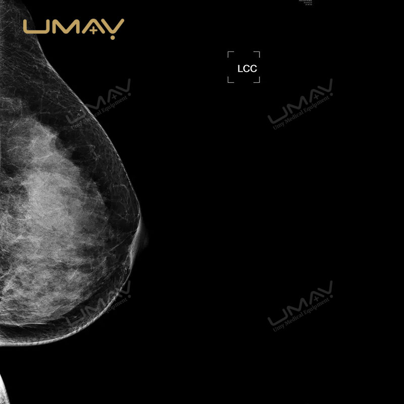 Digital Mammography System for Breast Disease Examination with DR Technology