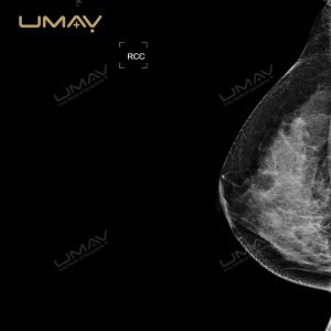 Digital Mammography System for Breast Disease Examination with DR Technology-6