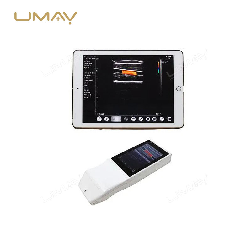 Handheld Wireless Linear Array Ultrasound Probe with WiFi Connectivity