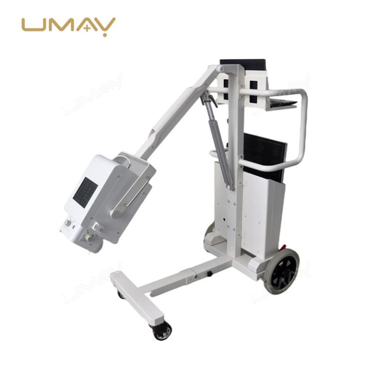 High-Power Mobile Digital X-ray Machine for Advanced Medical Imaging