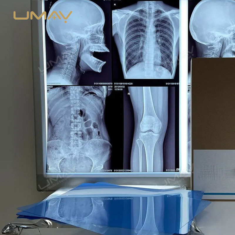 Medical Inkjet Printer for X-ray Blue Film, CT, and MRI Imaging