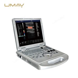 Portable 3D 4D 5D Color Doppler Ultrasound Machine with PW CW for Cost-Effective Diagnostics-1