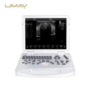 Portable 3D 4D 5D Color Doppler Ultrasound Machine with PW CW for Cost-Effective Diagnostics-2