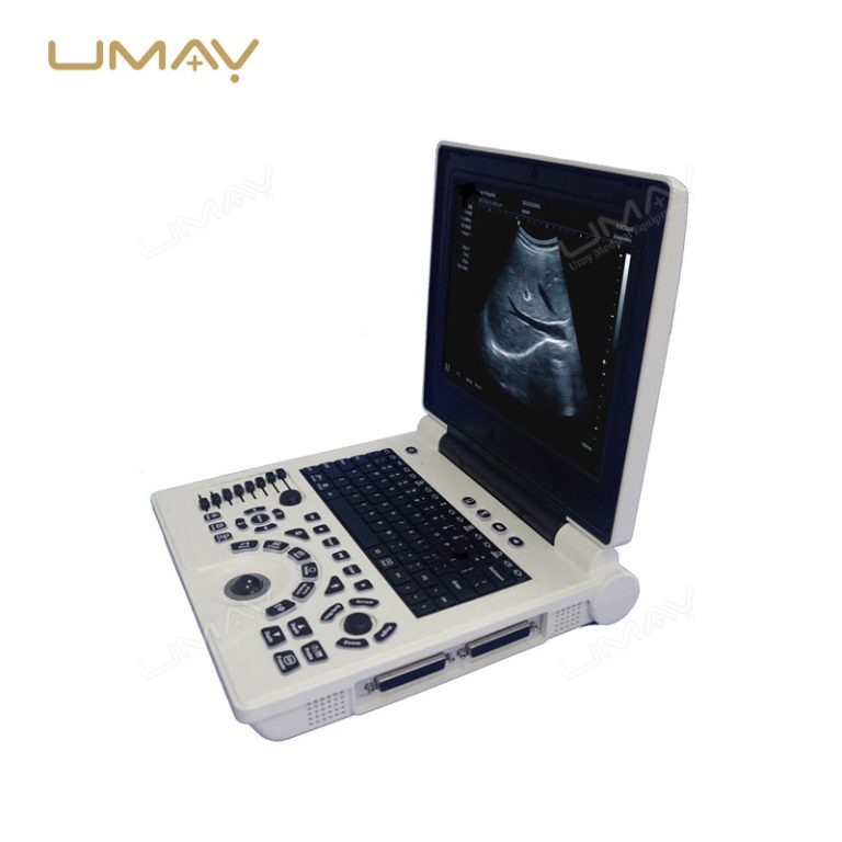 Portable 3D/4D Color Doppler Ultrasound Machine with High-Quality Imaging