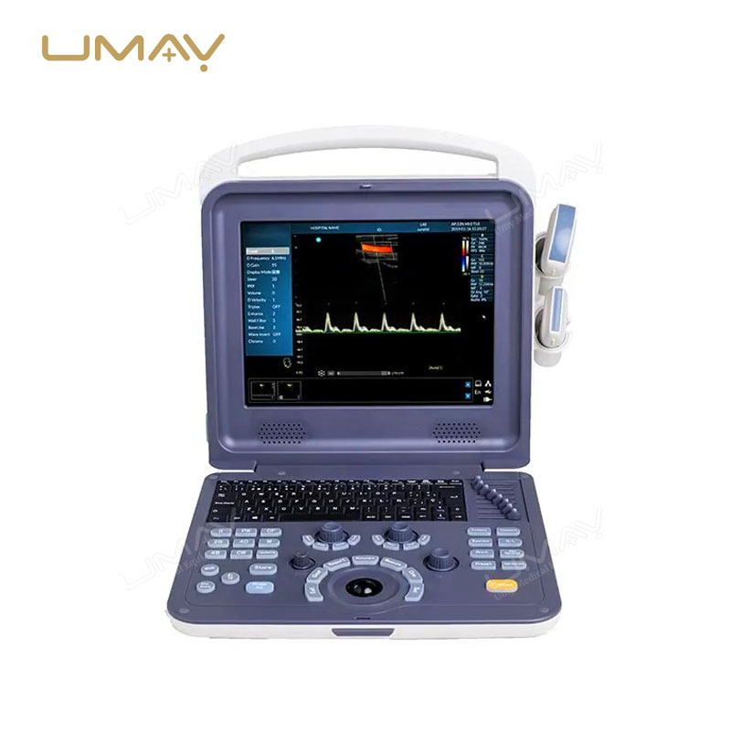 Portable 3D/4D Color Doppler Laptop Ultrasound Scanner