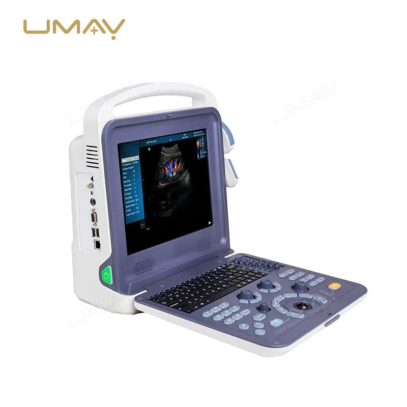 Portable 3D/4D Color Doppler Laptop Ultrasound Scanner