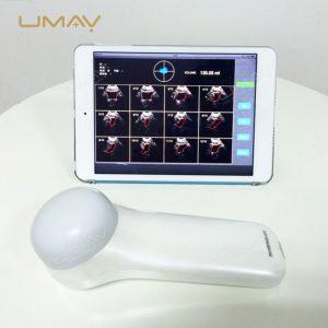 Portable 4D Wireless Bladder Scanner with High-Speed Imaging and Processing-4