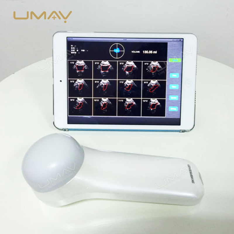 Portable 4D Wireless Bladder Scanner with High-Speed Imaging and Processing