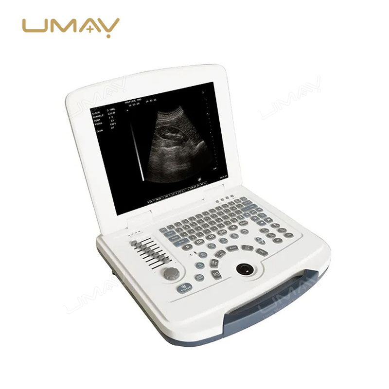 Portable Black and White Ultrasound Scanner Machine for Medical Imaging