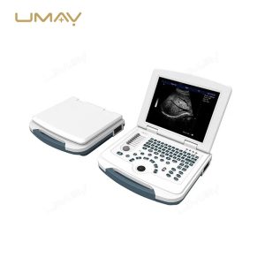 Portable Black and White Ultrasound Scanner Machine for Medical Imaging-2