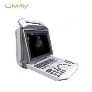 Portable Black and White Ultrasound Scanner with 12-Inch LED Screen for Human and Veterinary Use-1