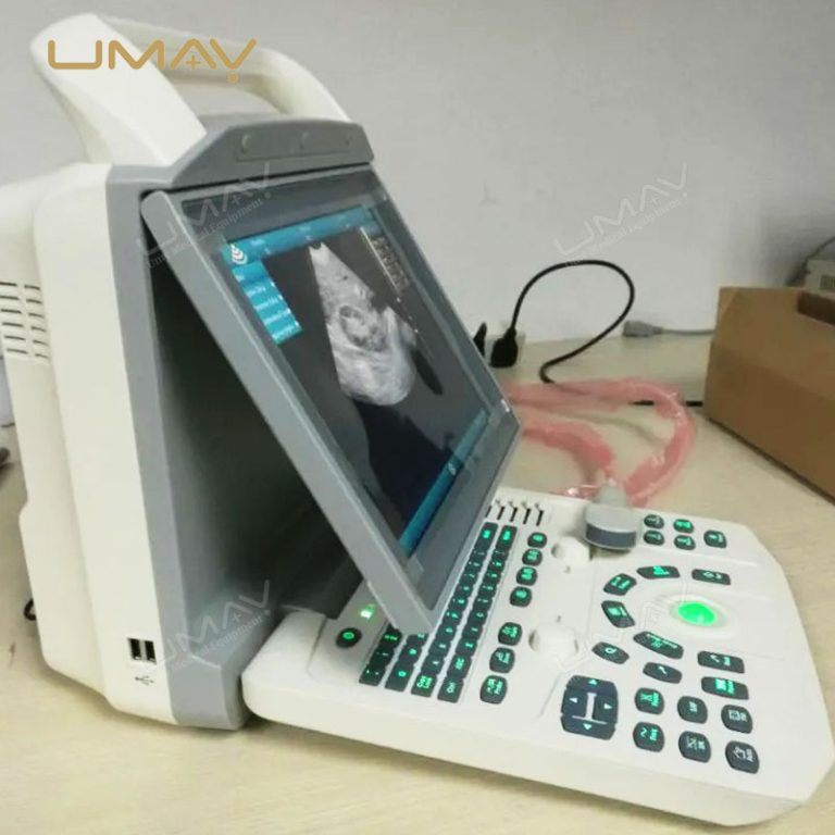 Portable Black and White Ultrasound Scanner with 12-Inch LED Screen for Human and Veterinary Use-3