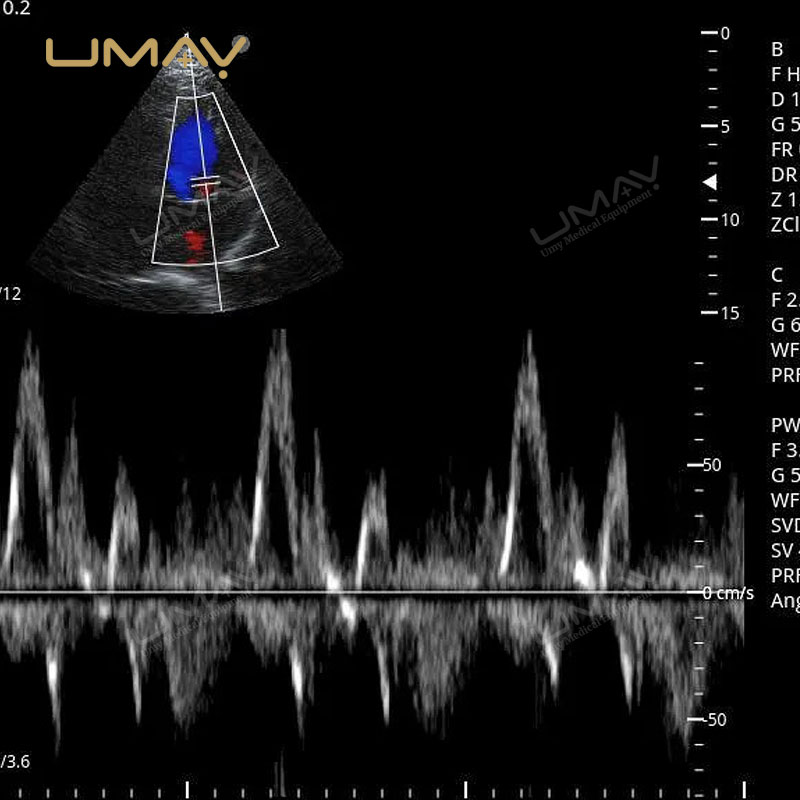 Portable Digital Color Doppler Ultrasound Machine for Human and Veterinary Use