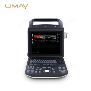 Portable Digital Color Doppler Ultrasound Machine for Human and Veterinary Use-4