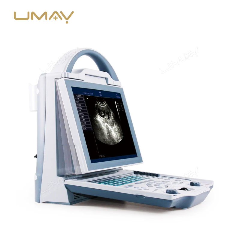 Portable Full Digital LED Ultrasound Scanner for Human Diagnostics