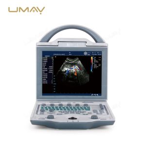 Portable Full Digital LED Ultrasound Scanner for Human Diagnostics-2