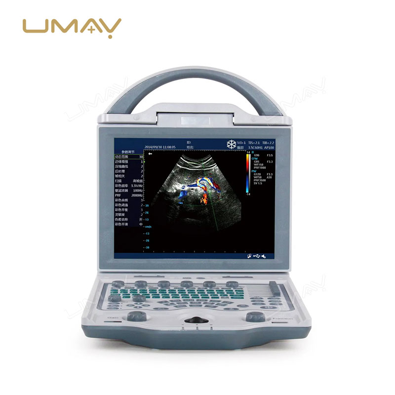 Portable Full Digital LED Ultrasound Scanner for Human Diagnostics