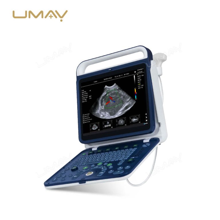 Portable Hand-Carried Veterinary Color Doppler Ultrasound Machine for Farm Use