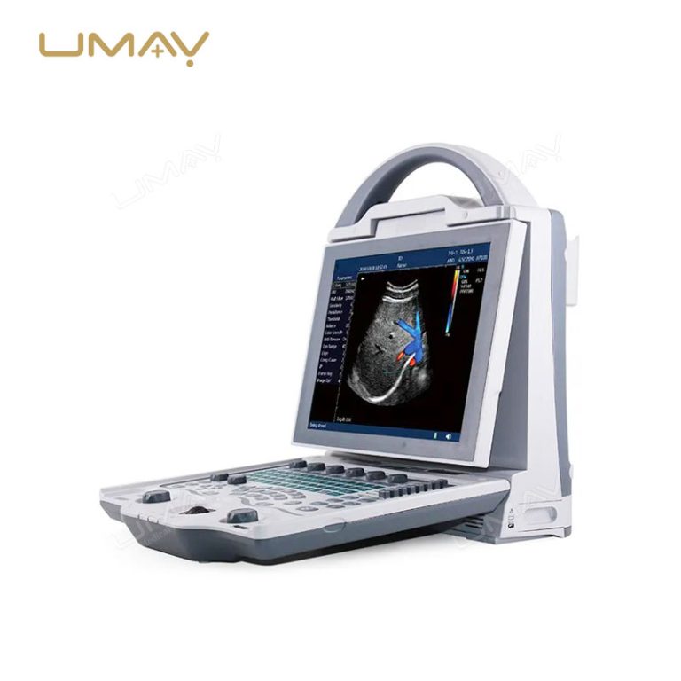 Portable Ophthalmic AB Scan Color Doppler Ultrasound Machine-2