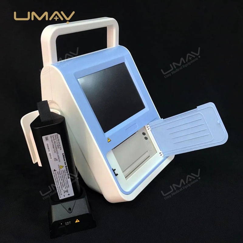 Touch Screen Portable 3D Bladder Volume Ultrasound Diagnostic Scanner