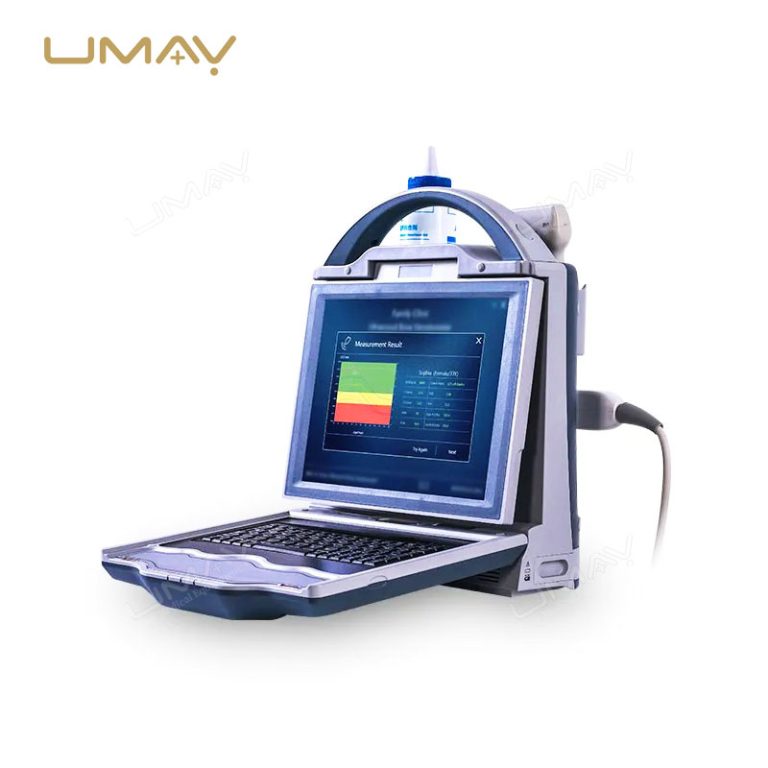 Ultrasonic Bone Densitometer for Bone Density Assessment in Hospitals