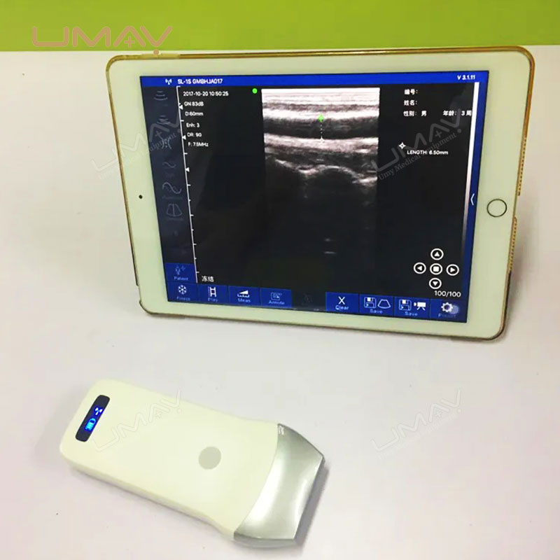 Wireless Convex and Linear Ultrasound Probes for Android Compatibility