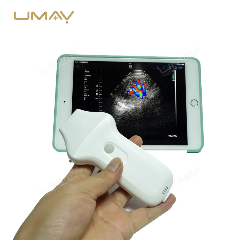 Wireless Phased Array Cardiac Ultrasound Probe for Echocardiography