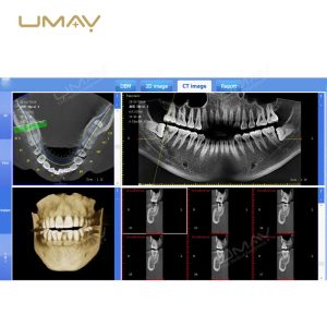 3D CBCT Dental Panoramic X-Ray Machine for Fine-Detail Imaging-1