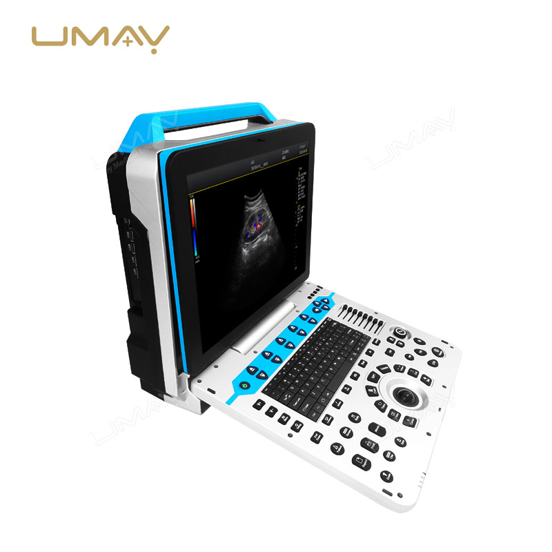 Advanced 4D Color Doppler Ultrasonic Diagnostic System for Medical Imaging