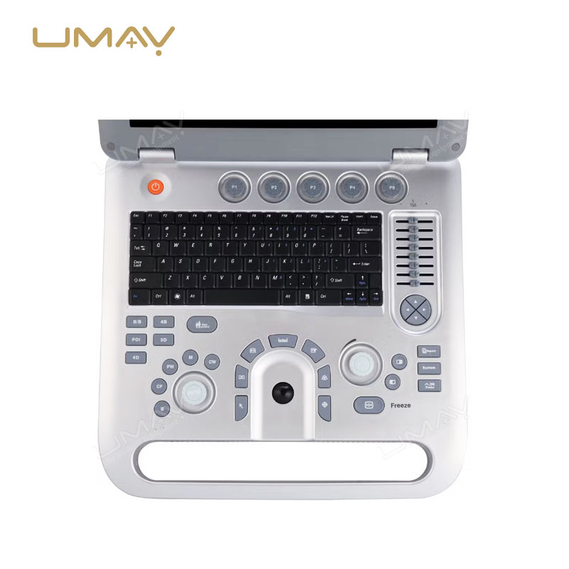 Color Doppler Laptop Ultrasound Machine with Superior Image Quality