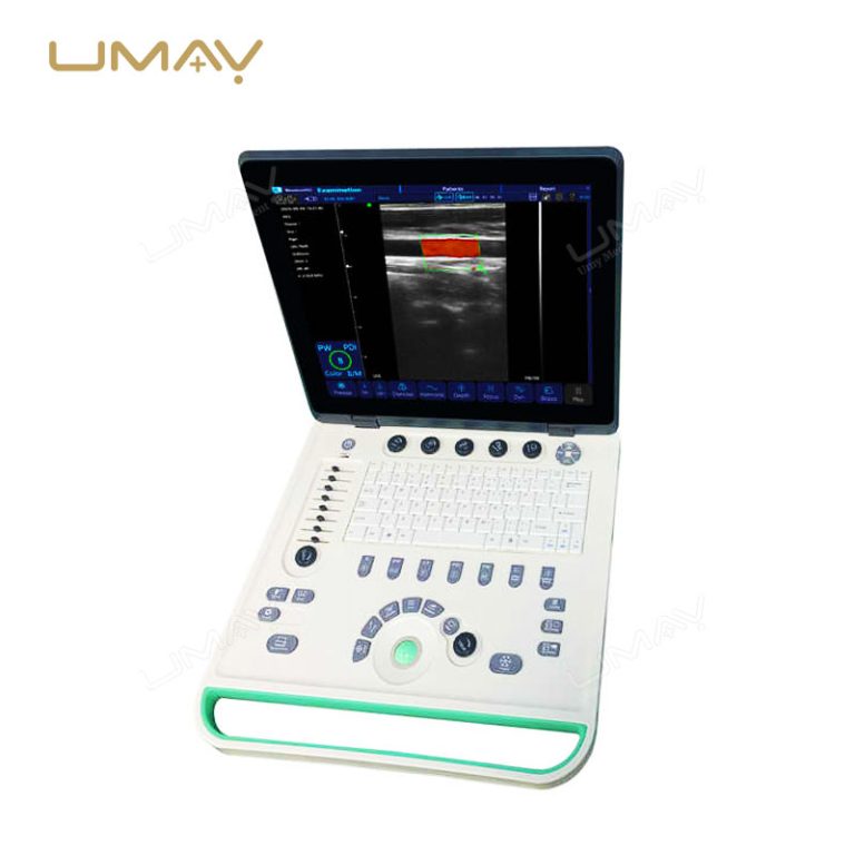 Cost-Effective Color Doppler Ultrasound Machine with High-Quality Imaging