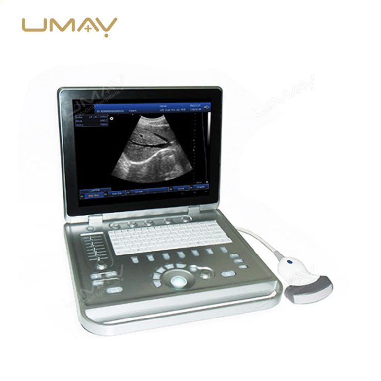 Full Digital Portable Laptop Ultrasound Instrument with Crystal-Clear Imaging-2