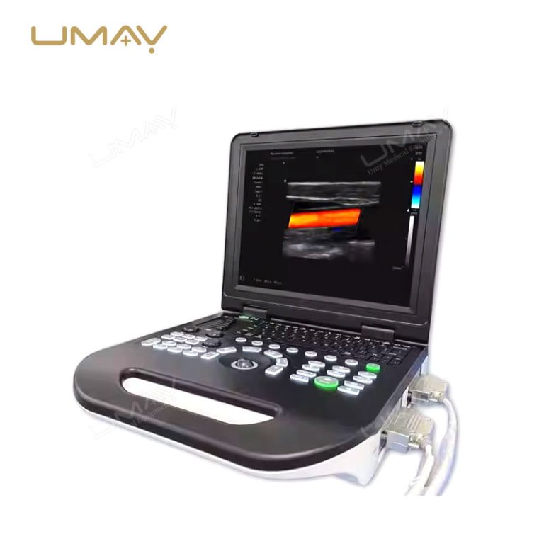 High-Quality Portable 3D Color Doppler Ultrasound Machine for Hospitals at Factory Price-1