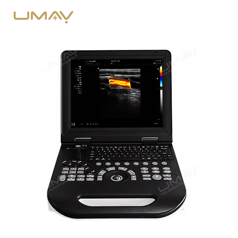 High-Quality Portable 3D Color Doppler Ultrasound Machine for Hospitals at Factory Price