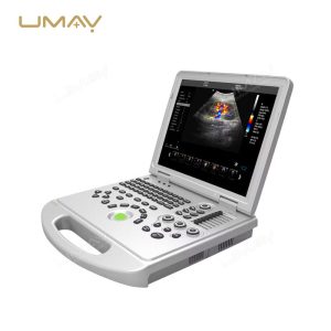 High-Resolution 4D Color Doppler Laptop Ultrasound Machine-2