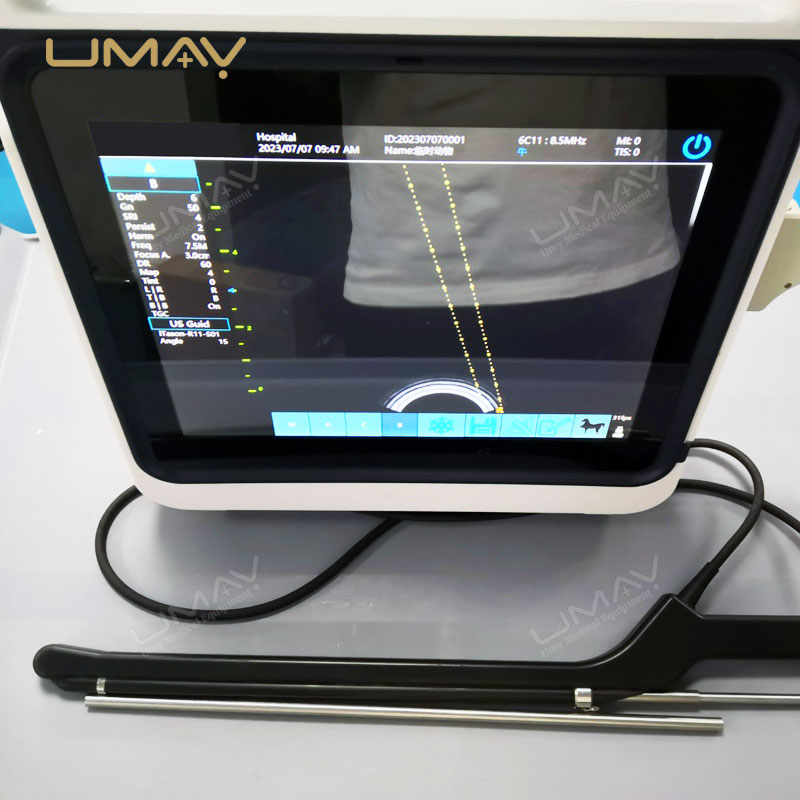 Point-of-Care Color Doppler Ultrasound System with Touchscreen for Ovum Pick-Up Procedures