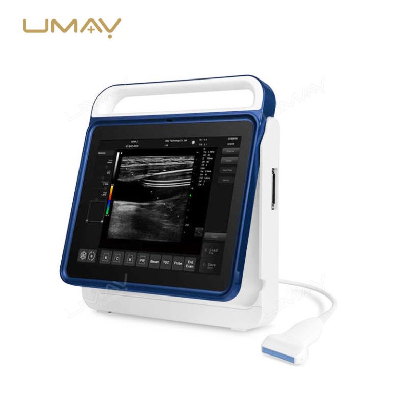 Point-of-Care Color Doppler Ultrasound System with Touchscreen for Ovum Pick-Up Procedures-2